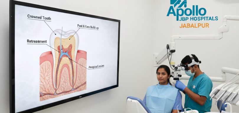 Retreatment of a crowned tooth with post & core build-up and periapical lesion