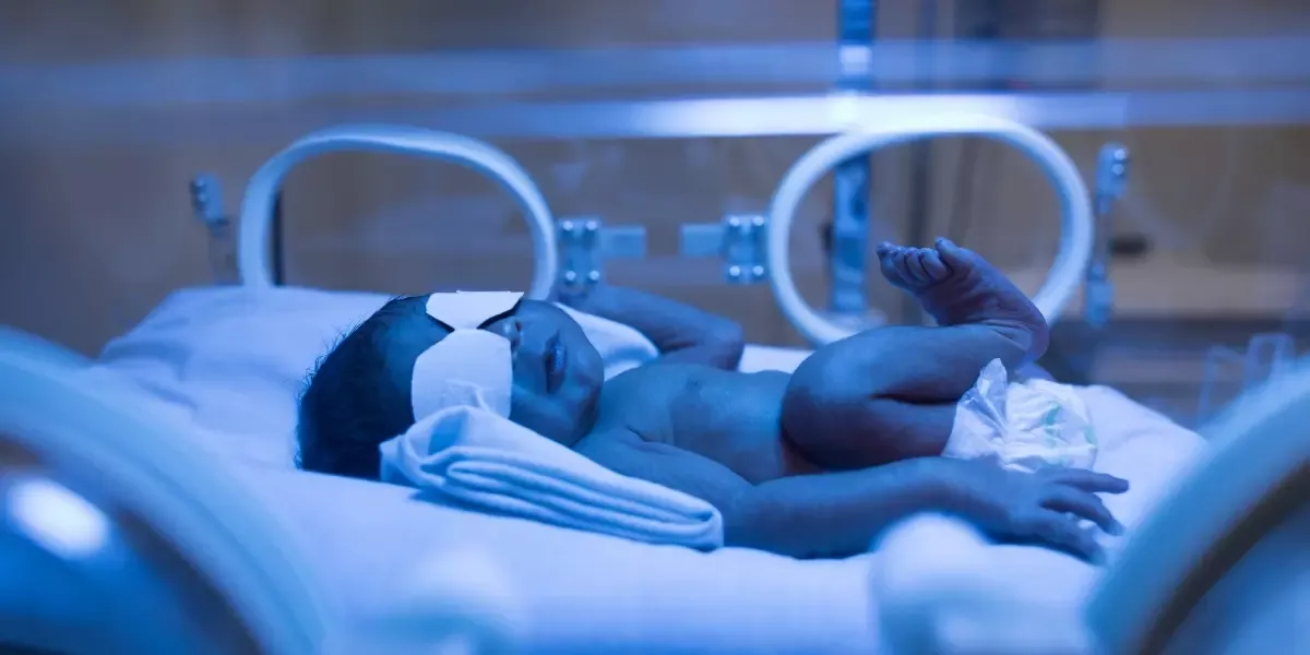 Phototherapy for jaundice apollo jbp hospitals