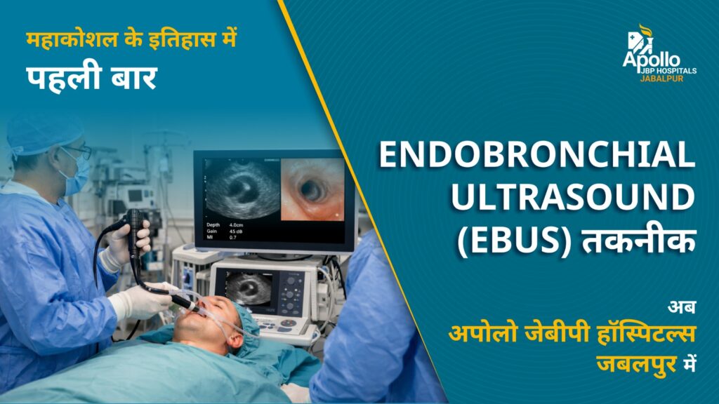 First Time In Mahakoshal – Advanced Ebus Technology Now Available At Apollo Jbp Hospitals, Jabalpur 1 Whatsapp image 2026 02 26 at 3. 14. 15 pm